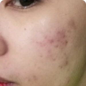 HONEYZUI02 after using Eslite