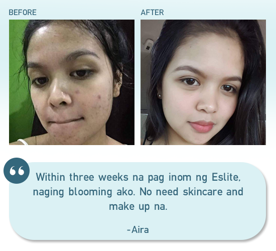 Eslite S-Acetyl Glutathione