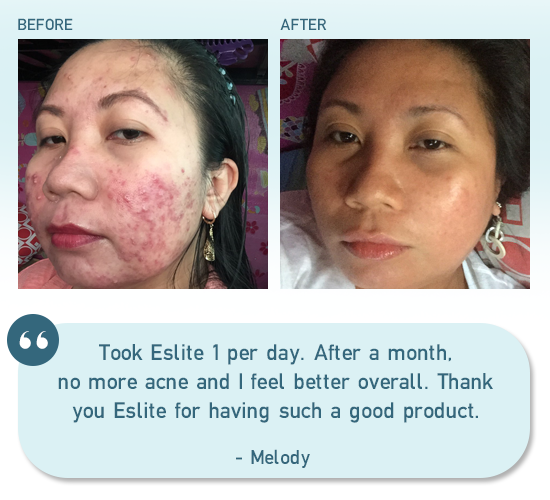 Eslite S-Acetyl Glutathione