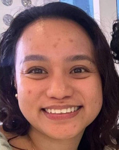 Priscilla before using Eslite