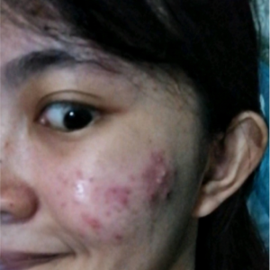 HONEYZUI02 before using Eslite