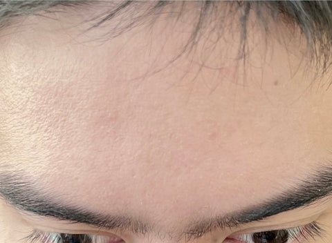DR MELVIN M. after using Eslite