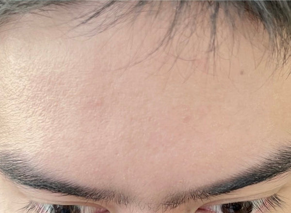 DR MELVIN M. after using Eslite