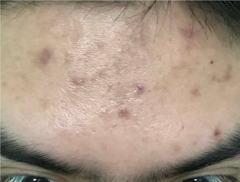 DR MELVIN M. before using Eslite