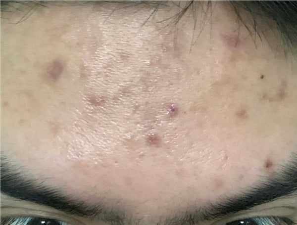 DR MELVIN M. before using Eslite