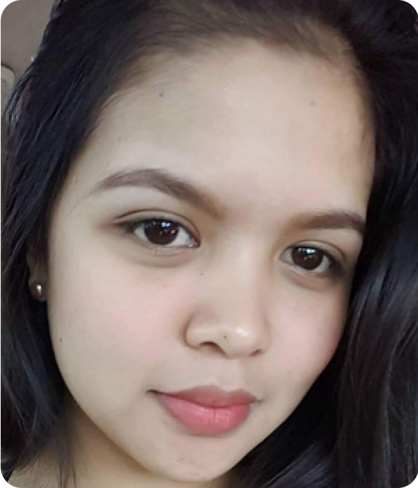 AIRA after using Eslite