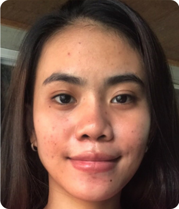 LARA before using Eslite