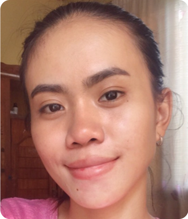 LARA after using Eslite
