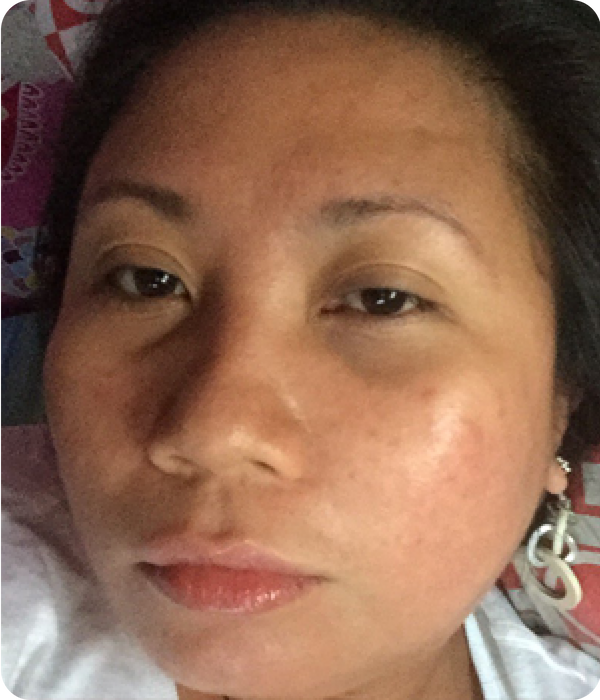 MELODY after using Eslite